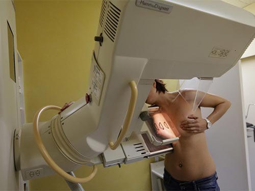 Phát hiện thuốc giảm hơn 50% nguy cơ ung thư vú